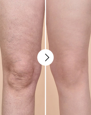 Cellinea tablets for cellulite and improving skin condition with natural extracts 60 capsules_4 - 4