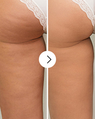 Cellinea tablets for cellulite and improving skin condition with natural extracts 60 capsules_2 - 2
