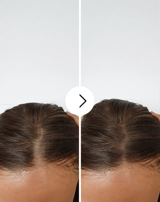 Follixin capsules for hair loss with a thickening and strengthening effect 60 capsules_4 - 4